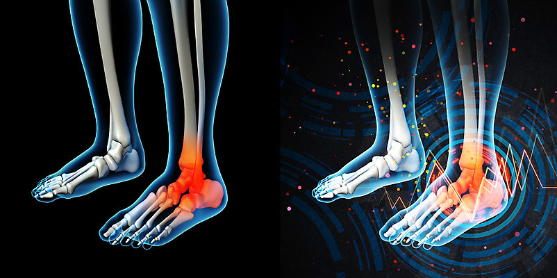 포토 JPG 해외이미지 신체 해부 엑스레이 사람 사람없음 치료 건강관리 고통 관절염 발가락 외과 발목 염증 정형외과 증상 해외202004 해외포토 감정 의학 발 건강 병원 관리 질병 파일형식