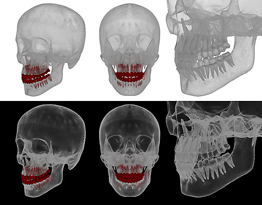 포토 JPG 해외이미지 백그라운드 건강 치과 사람없음 치료 3D 시험 흰색 입 치아 청소 오브젝트 치과의사 예방 망사 고립 돌봄 썩음 위생관리 치통 가상 해외202004 해외포토 교육 컬러 의학 모션 병원 관리 신체부위 의사 직물 소화기관 질병 디지털합성 파일형식
