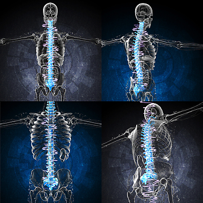 포토 JPG 해외이미지 뼈 골격 사람없음 3D 환자 질병 척추 몸통 방사선 요통 해외202004 해외포토 의학 신체부위 디지털합성 허리통증 파일형식