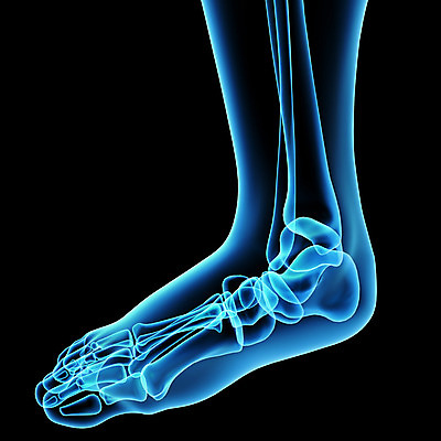 포토 JPG 해외이미지 신체 해부 엑스레이 사람 사람없음 치료 건강관리 고통 관절염 발가락 외과 발목 염증 정형외과 증상 해외202004 해외포토 감정 의학 발 건강 병원 관리 질병 파일형식