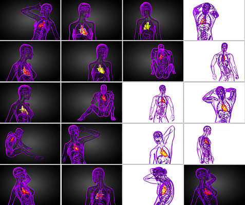포토 JPG 해외이미지 해부 건강 사람 사람없음 3D 고통 환자 하트 맥박 시스템 외과 심장병 해외202004 해외포토 모양 감정 의학 병원 질병 디지털합성 파일형식