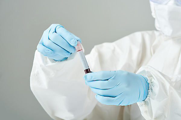 포토 JPG 스튜디오촬영 손 여자 40대 과학 의학 회색배경 실내 실험 마스크 한명 들기 앞모습 한국인 혈액 바이러스 연구원 사회이슈 검사_조사 감염 전염병 중년여자한명만 코로나바이러스 방호복 바이알 델타변이바이러스 국내포토 직업 1 옷 뷰포인트 중년 백그라운드 컨셉 모션 사람 동양인 내부 신체부위 회색 의료용품 질병 여자한명만 중년여자만 파일형식