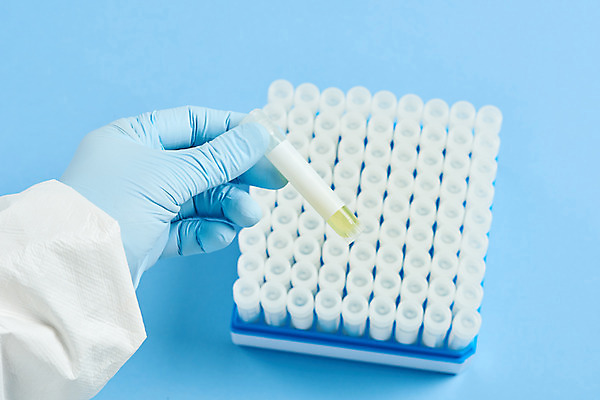 포토 JPG 스튜디오촬영 손 여자 40대 과학 의학 실내 실험 한명 들기 한국인 바이러스 연구원 사회이슈 검사_조사 파란배경 감염 전염병 중년여자한명만 코로나바이러스 방호복 바이알 델타변이바이러스 국내포토 직업 1 옷 중년 백그라운드 컨셉 모션 사람 동양인 내부 신체부위 파란색 의료용품 질병 여자한명만 중년여자만 파일형식