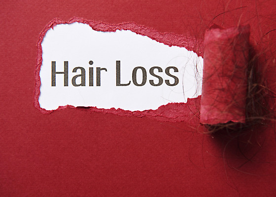 포토 JPG 스튜디오촬영 영어 실내 사람없음 단어 하이앵글 머리카락 질병 오브젝트 헤어관리 두피관리 빨간배경 탈모 플랫레이 국내포토 문자 뷰포인트 백그라운드 의학 내부 빨간색 뷰티 머리 플랫 증상 파일형식