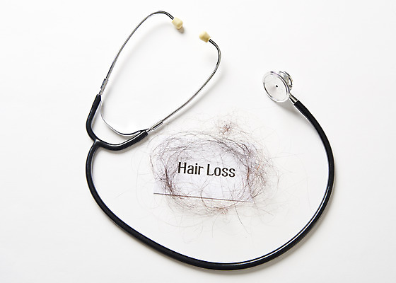 포토 JPG 스튜디오촬영 영어 청진기 실내 사람없음 단어 하이앵글 머리카락 질병 오브젝트 흰배경 헤어관리 두피관리 탈모 플랫레이 국내포토 문자 뷰포인트 백그라운드 의학 의료기기 내부 뷰티 머리 흰색 플랫 증상 파일형식