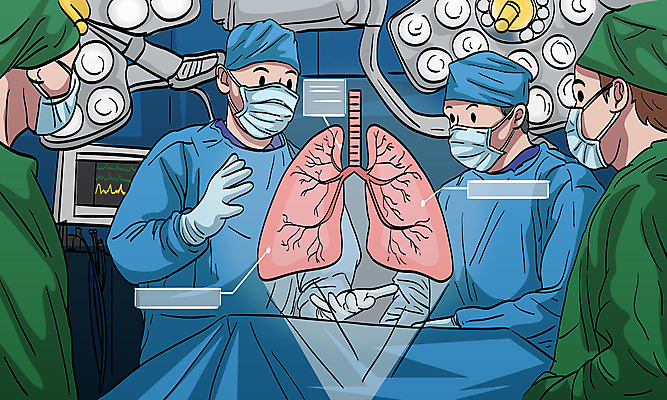 여자 남자 장갑 일러스트 마스크 여러명 상반신 성인 경제 의사 심장 수술 허파 수술복 수술실 수술기구 성인만 국내일러스트 AI파일 잡화 다수 의학 의료기기 사람 치료 의료진 가운 장기_의학 호흡기관 파일형식 벡터