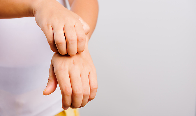 포토 JPG 해외이미지 손 여자 음식 곤충 신체 손가락 태국 건조 건강 관리 한명 동양인 30대 약 고통 짜증 뜨거움 질병 상처 피부 감염 문제 팔 토막 알레르기 반응 볼록 화학약품 카피스페이스 해외202007 해외포토 동물 1 감정 아시아 컨셉 의학 사람 인종 신체부위 장년 공백 화학 물질 파일형식