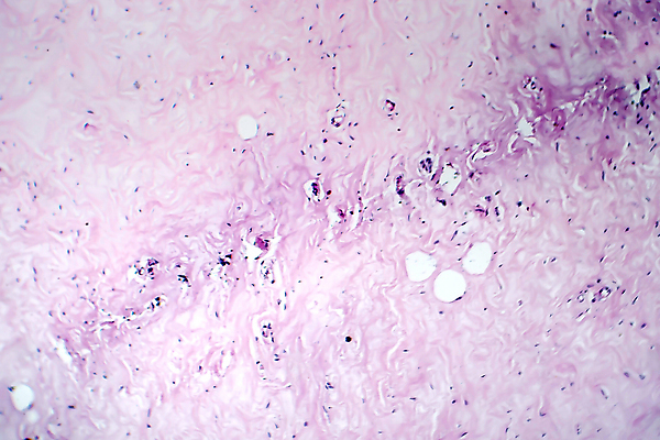 포토 JPG 해외이미지 여자 현미경 사람없음 약 얼룩 조직 변화 확대 질병 가슴 해외202008 해외포토 컨셉 의학 실험기구 사람 신체부위 파일형식
