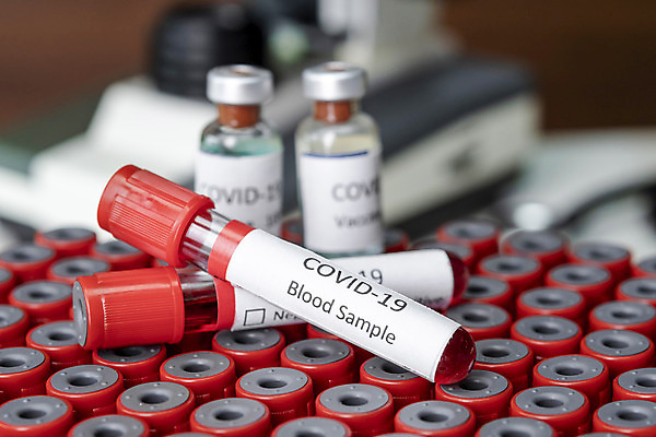 포토 JPG 해외이미지 실험 사람없음 아웃포커스 시험관 코로나3법 신약개발 해외202008 해외포토 촬영기법 실험기구 법 개발 파일형식 신약_의학