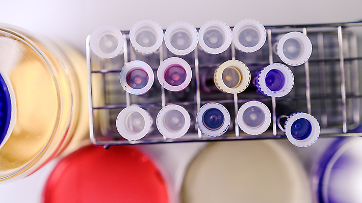 포토 JPG 해외이미지 그릇 과학 컨셉 건강 병원 실험 사람없음 치료 스터디 약 우주 장비 액체 실험실 바이러스 질병 생명공학 플라스크 분석 생물학 감염 미생물 튜브 조제 혁명 개발 돌봄 피펫 화학물질 살균 해외202008 해외포토 식기 교육 의학 모션 생물 실험기구 학습 화학 만들기 파일형식