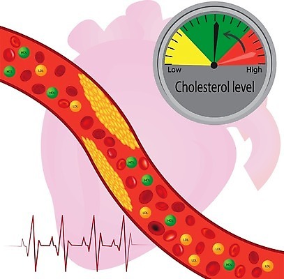 EPS 해외이미지 라이프스타일 컨셉 일러스트 손상 위험 공격 비만 눈금 순환 테이프 명패 심장병 해외202008 해외일러스트 모션 문구용품 생활 질병 몸매 파일형식 벡터