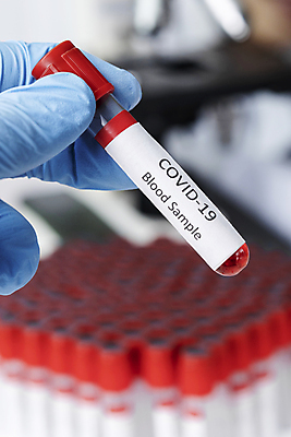 포토 JPG 해외이미지 손 실험 들기 근접촬영 아웃포커스 신체부위 시험관 신약개발 해외202008 해외포토 뷰포인트 모션 촬영기법 실험기구 사람 개발 파일형식 신약_의학