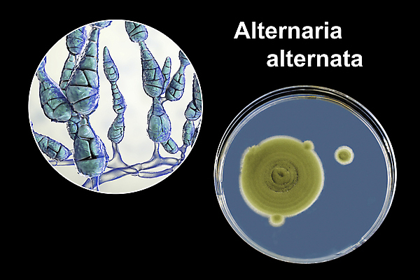포토 JPG 해외이미지 식물 접시 잎 일러스트 사람 사람없음 3D 흙 열 호흡기관 질병 피부 감염 알레르기 곰팡이 식민지 해외202008 해외포토 식기 의학 신체부위 장기_의학 디지털합성 파일형식