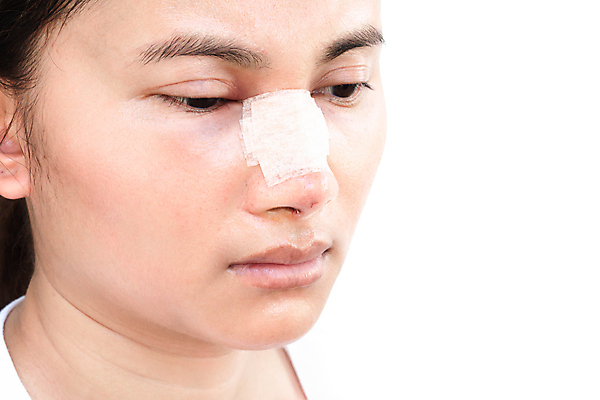 포토 JPG 해외이미지 손 여자 얼굴 백그라운드 컨셉 신체 건강 한명 사람 치료 파란색 빛 뷰티 약 유행 화장품 의사 흰색 수술 플라스틱 피부 입술 코 외과 고립 스타일 카피스페이스 해외202008 해외포토 1 컬러 의학 재질 병원 신체부위 공백 의료진 파일형식