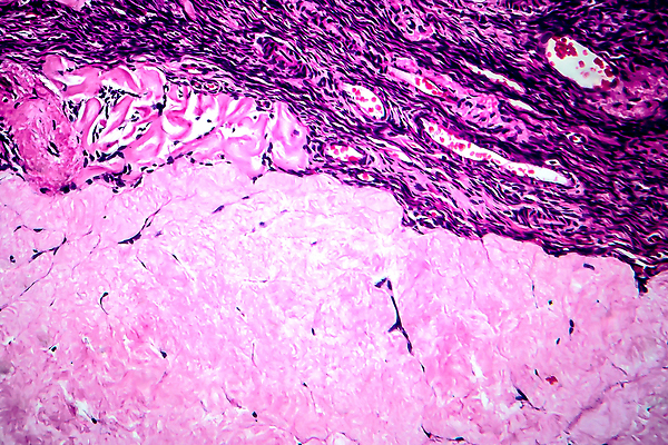 포토 JPG 해외이미지 여자 현미경 사람없음 약 얼룩 조직 확대 질병 해외202008 해외포토 의학 실험기구 사람 파일형식