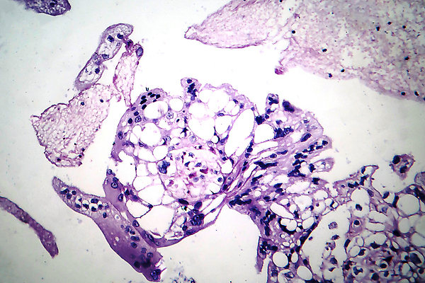 포토 JPG 해외이미지 여자 현미경 사람없음 약 임신 얼룩 조직 확대 질병 자궁 두더지 완전 해외202008 해외포토 컨셉 의학 실험기구 사람 장기_의학 파일형식