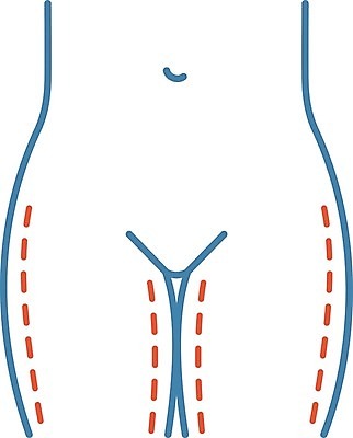 EPS 해외이미지 클립아트 모양 디자인 여자 컨셉 신체 일러스트 병원 치료 파란색 픽토그램 뷰티 약 웹 화장품 환자 수술 플라스틱 엉덩이 만화 하락 가득함 심볼 피부 서비스 그림 윤곽 외과 허벅지 순서 고립 돌봄 리프팅 스타일 해외202008 해외일러스트 컬러 인터넷 의학 모션 재질 사람 신체부위 파일형식 벡터