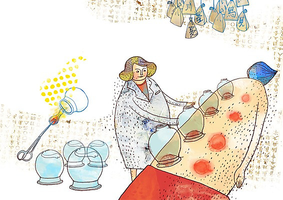 PSD 여자 남자 일러스트 의학 불 집게 사람 두명 치료 한의학 환자 의사 한약재 등 한약 한의원 한의사 부항 부항시술 국내일러스트 자연요소 병원 신체부위 약 의료진 약재 파일형식