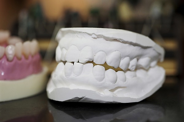 포토 JPG 실내 치과 사람없음 아웃포커스 모형 의료용품 치아 치과용품 치아모형 국내포토 의료기기 촬영기법 병원 내부 소화기관 파일형식