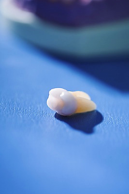 포토 JPG 실내 치과 근접촬영 사람없음 아웃포커스 한개 의료용품 치아 치과용품 티타늄 국내포토 1 뷰포인트 의료기기 촬영기법 병원 내부 소화기관 원소 파일형식