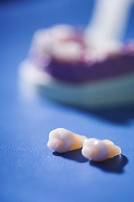 포토 JPG 실내 치과 근접촬영 사람없음 아웃포커스 두개 의료용품 치아 치과용품 티타늄 국내포토 뷰포인트 2 의료기기 촬영기법 병원 내부 소화기관 원소 파일형식