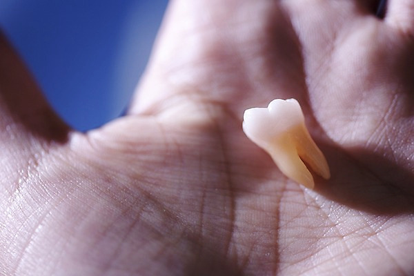 포토 JPG 손 실내 치과 손바닥 근접촬영 아웃포커스 신체부위 한개 의료용품 치아 치과용품 국내포토 1 뷰포인트 의료기기 촬영기법 병원 사람 내부 소화기관 파일형식