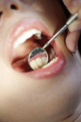 포토 JPG 손 의학 실내 치과 병원 입벌림 사람 동양인 근접촬영 신체부위 치료 반사 진료 거울 환자 의료용품 입 치아 입술 치과용품 치과진료 구강거울 국내포토 뷰포인트 의료기기 표정 인종 내부 소화기관 파일형식