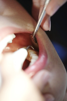 포토 JPG 손 의학 실내 치과 병원 입벌림 사람 동양인 근접촬영 신체부위 치료 진료 거울 환자 의료용품 입 치아 입술 치과용품 치과진료 치석제거기 구강거울 국내포토 뷰포인트 의료기기 표정 인종 내부 소화기관 파일형식