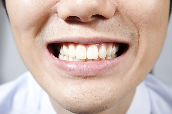 포토 JPG 의학 실내 치과 병원 사람 동양인 근접촬영 신체부위 치료 입 치아 입술 국내포토 뷰포인트 인종 내부 소화기관 파일형식