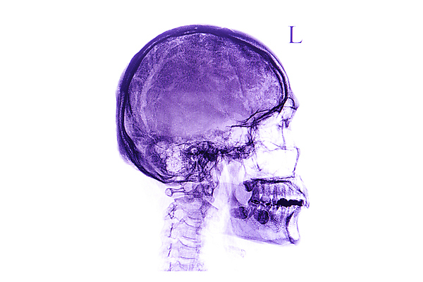 포토 JPG 해외이미지 얼굴 과학 백그라운드 신체 해부 뼈 골격 엑스레이 건강 병원 사람 사람없음 약 머리 시험 환자 광선 흰색 보행로 유령 질병 필름 척추 위치 목 고립 돌봄 해골모형 해외202008 해외포토 교육 길 컬러 의학 모션 신체부위 모형 파일형식