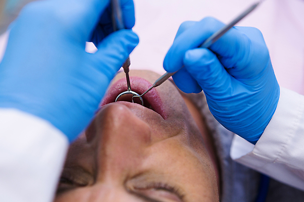 포토 JPG 해외이미지 손 남자 치과 병원 한명 앉기 상반신 성인 신체부위 치료 의사 치과진료 성인남자한명만 해외202008 해외포토 1 의학 모션 사람 진료 의료진 남자한명만 성인남자만 파일형식