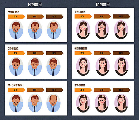 여자 남자 일러스트 종류 상반신 다양 예방 헤어관리 탈모 탈모클리닉 국내일러스트 AI파일 다수 사람 뷰티 클리닉 증상 파일형식 벡터