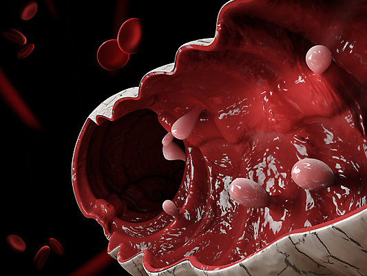 포토 JPG 해외이미지 과학 신체 일러스트 부분 해부 세포 건강 사람 사람없음 그래픽 치료 약 환자 막대기 오르간 유연 그림 생물학 시스템 섬유 암 외과 테라피 삭제 방사선 가상 해외202009 해외포토 교육 의학 병원 뷰티 직물 건반악기 질병 파일형식