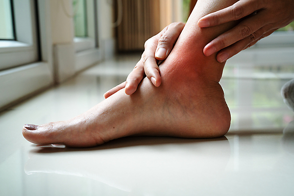 포토 JPG 해외이미지 라이프스타일 손 여자 아시아 스포츠 신체 근육 휴식 뼈 건강 사람 사람없음 약 스트레칭 고통 터치 마사지 업무 질병 상처 사건 피부 관절염 무릎 발가락 테라피 발목 깨짐 돌봄 물리치료 부담 양발 위생관리 정형외과 해외202009 해외포토 감정 나라 컨셉 의학 모션 발 병원 관리 생활 신체부위 치료 운동 뷰티 작업 파일형식