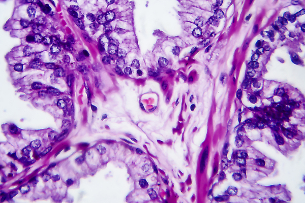 포토 JPG 해외이미지 남자 현미경 사람없음 약 얼룩 조직 변화 확대 질병 암 해외202009 해외포토 컨셉 의학 실험기구 사람 파일형식