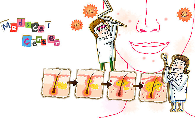 EPS 여자 남자 얼굴 일러스트 의학 자국 건강 병원 관리 미소 웃음 사람 성인 두명 치료 건강관리 진료 의사 광선 바이러스 장기 질병 상처 피부 질병관리 감각기관 고름 여드름 레이저치료 압출기 피부과 흉터 성인만 국내일러스트 신체 표정 신체부위 의료진 장기_의학 파일형식 벡터