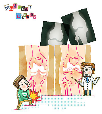 EPS 남자 일러스트 의학 뼈 엑스레이 건강 병원 사람 성인 두명 신체부위 치료 건강관리 계단 진료 고통 환자 의사 장기 질병 근골격기관 질병관리 관절염 관절 무릎 골절 연골 남자만 성인남자만 성인만 국내일러스트 감정 신체 관리 의료진 장기_의학 파일형식 벡터