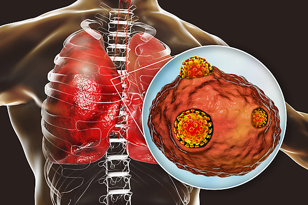 포토 JPG 해외이미지 과학 신체 일러스트 해부 현미경 사람 사람없음 글로벌 약 3D 중국 호흡기관 바이러스 질병 감염 테라피 백신 전염병 해외202009 해외포토 아시아 의학 실험기구 뷰티 장기_의학 디지털합성 파일형식