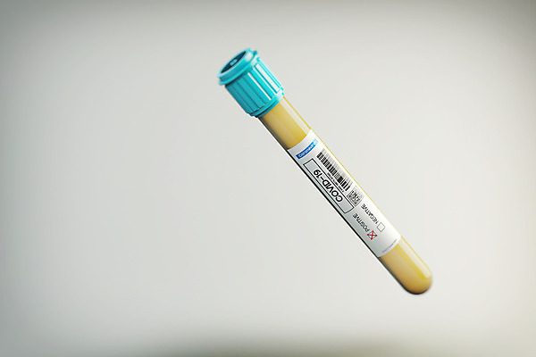 PSD 편집 편집이미지 의학 사람없음 약 3D소스 3D 약병 질병 사회이슈 디지털합성 시험관 백신 전염병 편집소스 코로나바이러스 백신개발 델타변이바이러스 편집3D 컨셉 실험기구 바이러스 개발 병_담는 파일형식