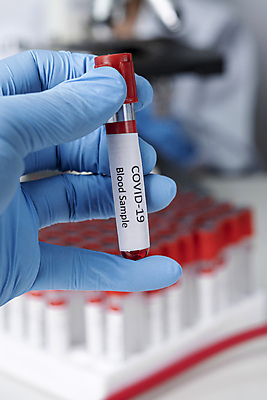 포토 JPG 해외이미지 손 건강 병원 들기 신체부위 장비 혈액 실험실 분석 시험관 백신 코로나바이러스 백신개발 해외202009 델타변이바이러스 해외포토 컨셉 의학 모션 실험기구 실험 사람 바이러스 개발 파일형식