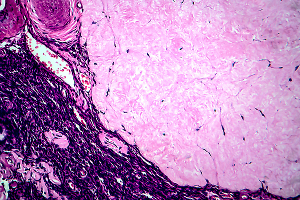 포토 JPG 해외이미지 여자 현미경 사람없음 약 얼룩 조직 확대 질병 해외202009 해외포토 의학 실험기구 사람 파일형식