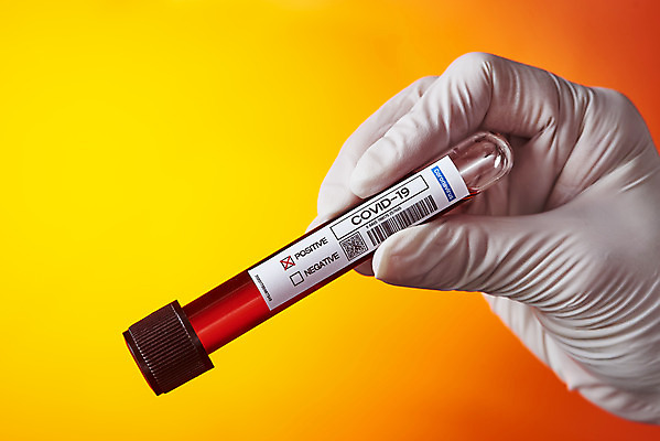 포토 JPG 스튜디오촬영 손 여자 과학 장갑 의학 실내 건강 한명 들기 사람 20대 신체부위 약 한국인 바이러스 질병 시험관 노란배경 백신 전염병 성인여자한명만 코로나바이러스 델타변이바이러스 국내포토 1 잡화 백그라운드 모션 실험기구 동양인 청년 내부 노란색 여자한명만 성인여자만 파일형식