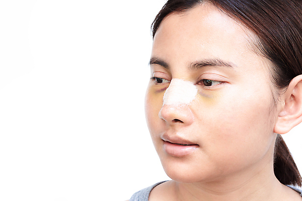 포토 JPG 해외이미지 여자 얼굴 백그라운드 컨셉 건강 한명 사람 치료 약 흰색 수술 플라스틱 피부 코 외과 의료성형뷰티 해외202011 해외포토 1 컬러 의학 재질 병원 신체부위 파일형식