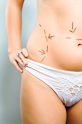 포토 JPG 해외이미지 백인 모델 여자 선 신체 화살 병원 성인 사람없음 청춘 뷰티 활발 환자 주름 수술 속옷 엉덩이 허리 흔적 사인 몸통 외과 허벅지 복부 의료성형뷰티 노화 셀룰라이트 해외202004 해외포토 서양인 옷 컨셉 의학 사람 신체부위 치료 파일형식