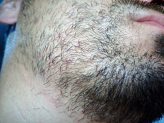 포토 JPG 해외이미지 백인 1 라이프스타일 남자 얼굴 백그라운드 컨셉 손가락 수염 갈색머리 사람 성인 사람없음 치료 갈색 검은색 어둠 화장품 흰색 입 닫기 피부 묘사 입술 질감 목 문제 면도기 턱 심각 의료성형뷰티 해외202011 해외포토 서양인 헤어스타일 손 컬러 의학 모션 생활 신체부위 위생용품 뷰티 파일형식