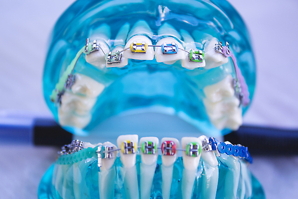 포토 JPG 해외이미지 모델 학생 건강 치과 사람없음 치료 금속 공구 도자기 투명 클래식 닫기 치아 치과의사 거짓 돌봄 의료성형뷰티 해외202011 해외포토 컨셉 의학 모션 재질 병원 의사 도구 소화기관 파일형식