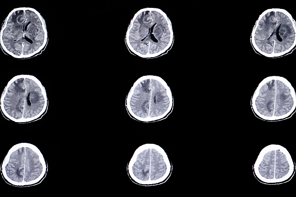 포토 JPG 해외이미지 백그라운드 해부 뼈 엑스레이 병원 사람 사람없음 치료 컴퓨터 약 머리 검은색 환자 의사 광선 흰색 긴급 반지 질병 큼 필름 뇌 감염 방사선 심각 에이즈 해골모형 의료성형뷰티 해외202011 해외포토 컬러 컨셉 장신구 의학 신체부위 전자제품 모형 의료진 크기 파일형식