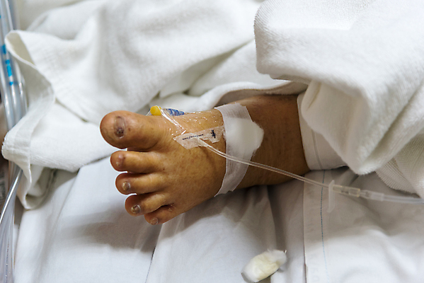 포토 JPG 해외이미지 컨셉 건강 병원 사람 성인 사람없음 치료 약 고통 환자 간호사 긴급 바늘 액체 주름 수술 질병 감염 튜브 발가락 주사약 암 외과 정맥 돌봄 복용 양발 제어 조부모 지원 치유 투입 헬프 의료성형뷰티 해외202011 해외포토 감정 의학 가족 모션 발 의료진 도구 도움 혈관 파일형식