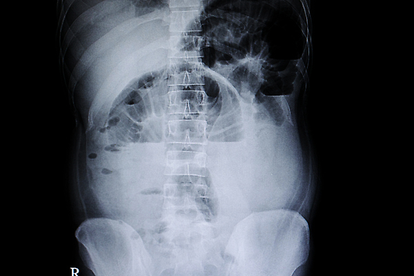 포토 JPG 해외이미지 백그라운드 패턴 신체 해부 뼈 골격 엑스레이 건강 병원 서기 사람 사람없음 약 고통 환자 의사 광선 흰색 질병 작음 큼 필름 위치 가스 돌봄 방사선 의료성형뷰티 해외202011 해외포토 감정 컬러 무늬 의학 모션 의료진 크기 파일형식