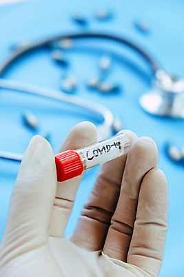 포토 JPG 해외이미지 무료이미지 유리병 실험 주사기 사람없음 약 환자 의사 바이러스 보호 질병 위험 사회이슈 시험관 감염 예방접종 항생제 해외202105 해외포토 컨셉 의학 의료기기 병_용기 실험기구 의료진 접종 파일형식 무료콘텐츠